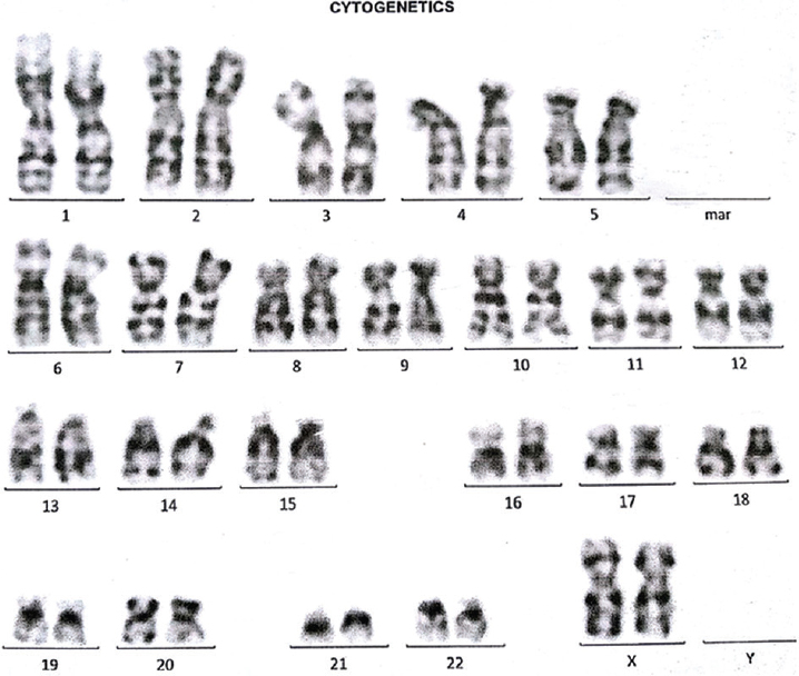 Normal karyotype map of the neonate.